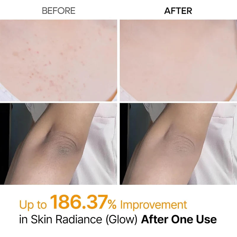 Peel Shot exfoliating kojic acid turmeric Spray 200 ml