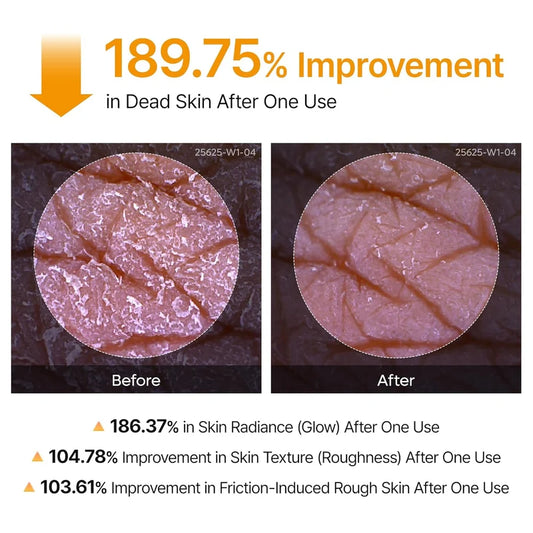 Peel Shot exfoliating kojic acid turmeric Spray 200 ml