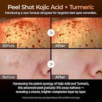 Dr. Melaxin Peel Shot Exfoliating Kojic Acid Turmeric Serum 80ml