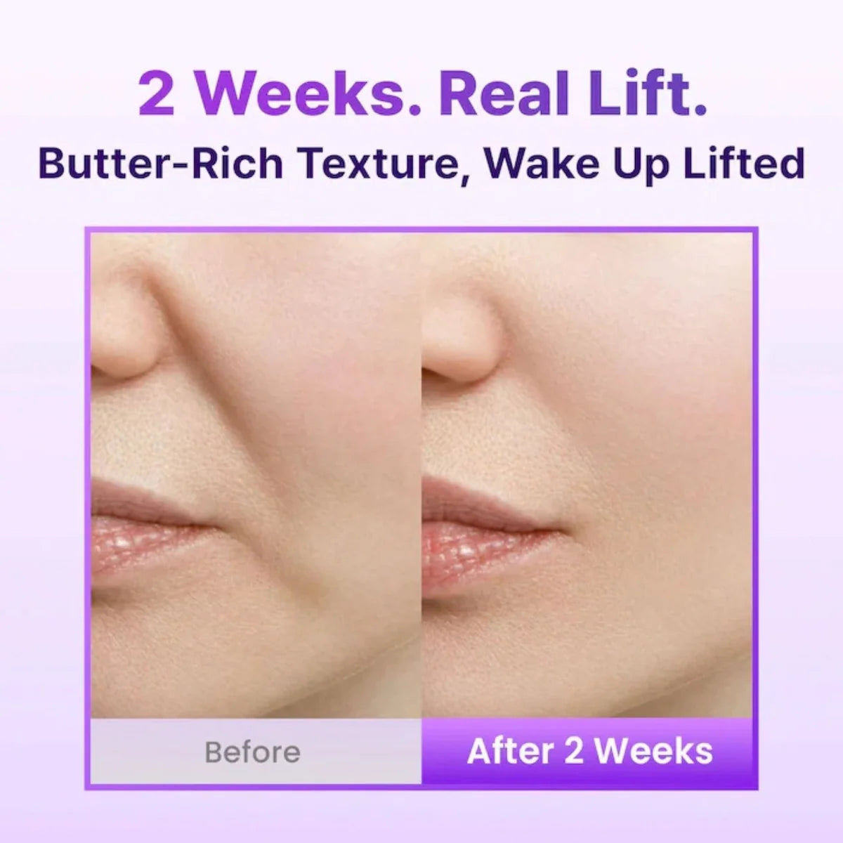 BIOHEAL BOH PROBIODERM™ 3D Lifting Cream