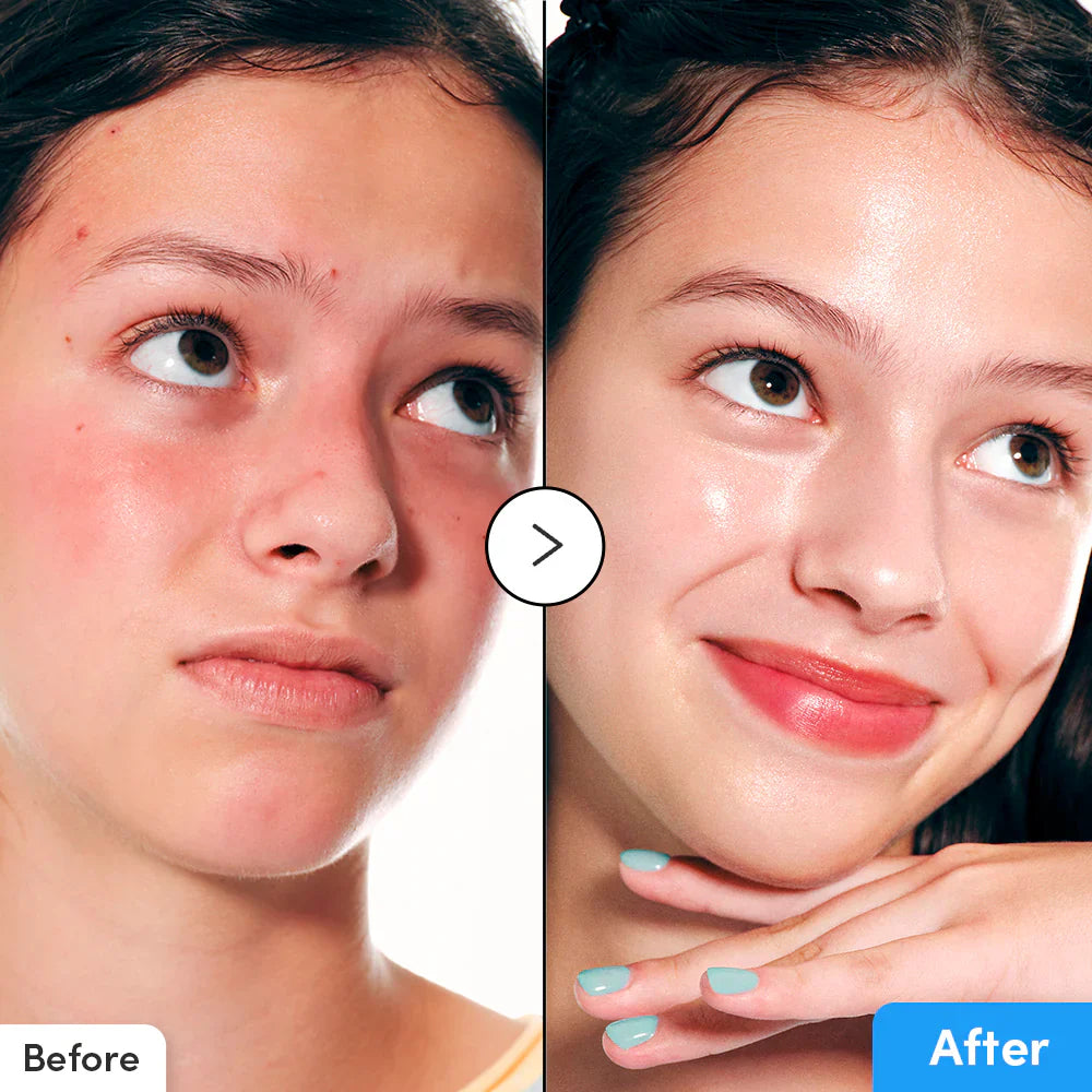 Eqqualberry Hyaltoin Flooding Serum