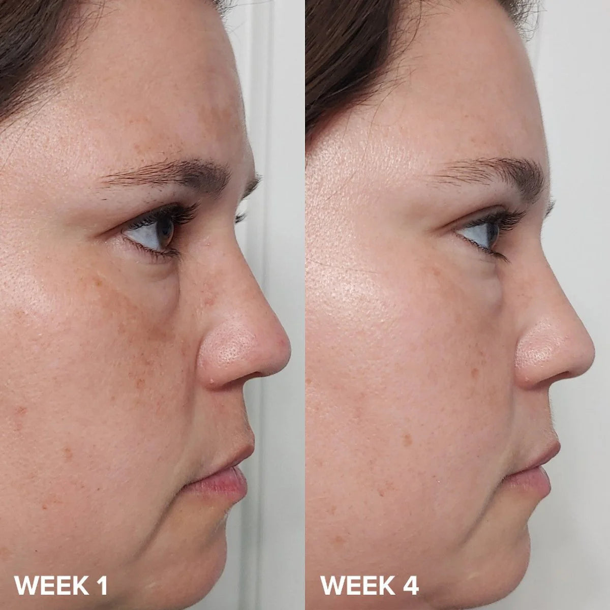 Paula’s Choice - Skin Perfecting 2% BHA Liquid Exfoliant